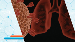 Med Uni Graz and Boehringer Ingelheim Open Lung Cancer Research Lab