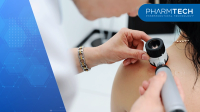 melanoma diagnosis. the doctor examines the patient's mole | Image Credit: ©Evgeniy Kalinovskiy -stock.adobe.com