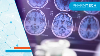 What Does TAUKLARIFY's Approval Mean for Alzheimer's Drug Developers?