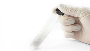 Raresb/Stock.adobe.com – In this study, elastic liposomes were characterized, and their biological activity was confirmed.