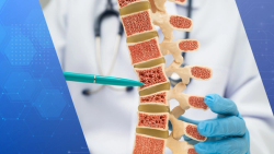 FDA-Designated Denosumab Biosimilars Enter US Market