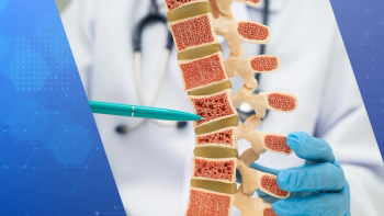 Biosimilars Targeting Osteoporosis Enter US Market