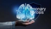 Medical banner Pulmonary fibrosis on blue background | Image Credit: © mi_viri -stock.adobe.com