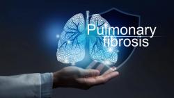 BirchBioMed’s Idiopathic Pulmonary Fibrosis Receives Orphan Drug Designation