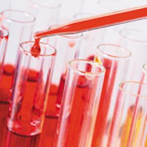 Analysis of Total and Transferrin-Bound Iron from Serum Samples