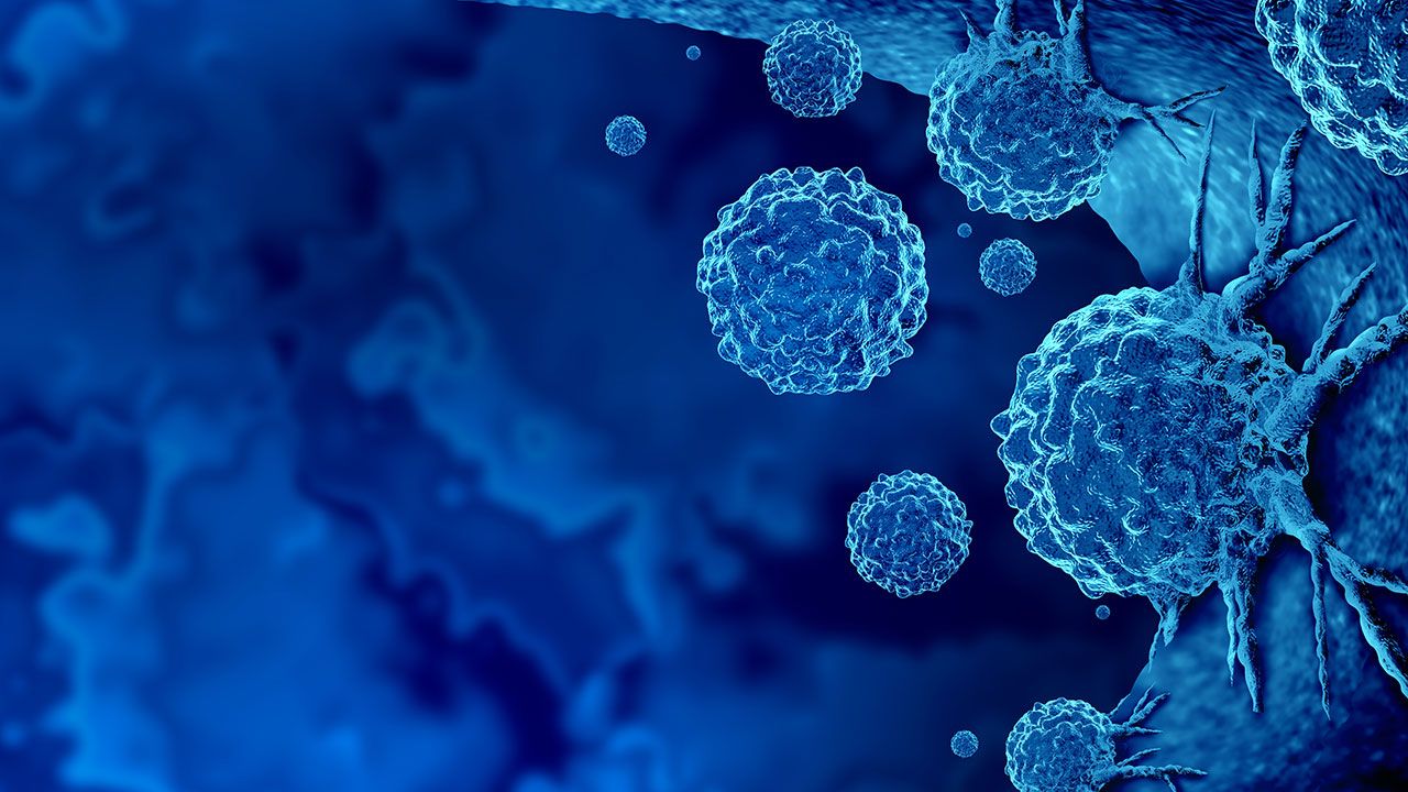Cancer Outbreak | Image Credit: ©freshidea -stock.adobe.com