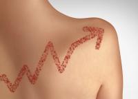 Is your practice ready for a measles patient? A 10-step checklist from Pennsylvania's outbreak