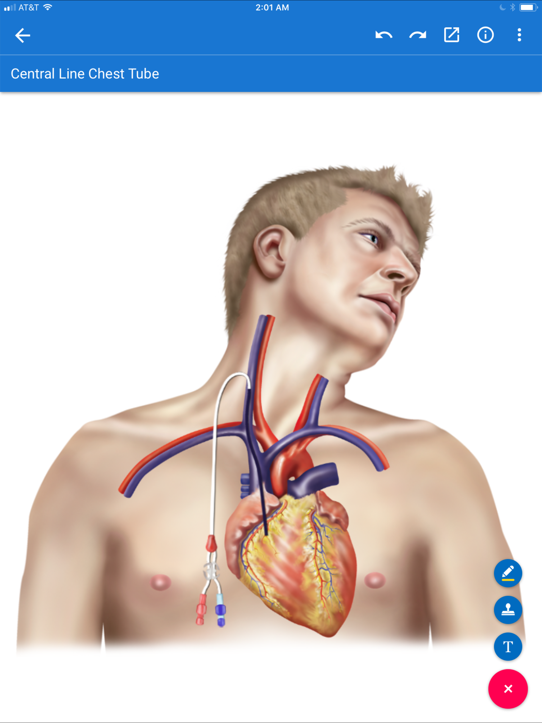 Photo Credit: drawMD