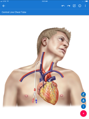 Photo Credit: drawMD