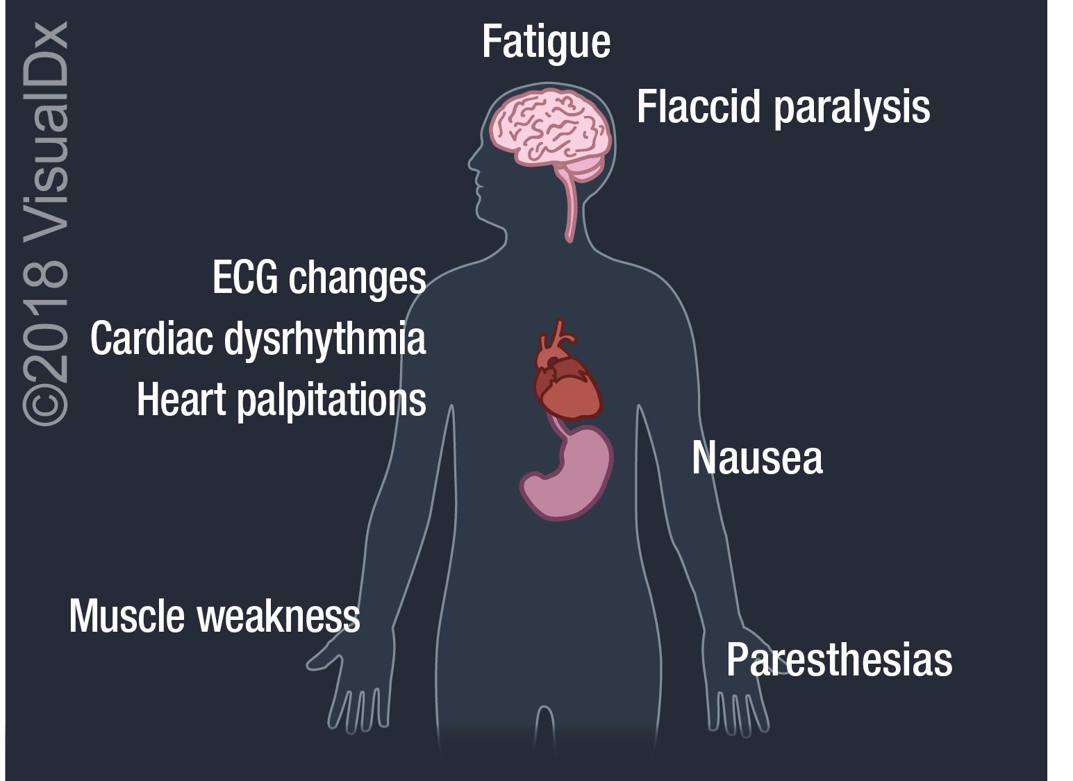 can undiagnosed diabetes cause heart palpitations