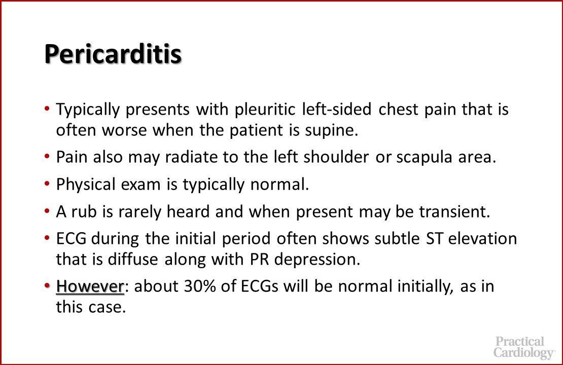Pericarditis, pneumonia, chest pain 