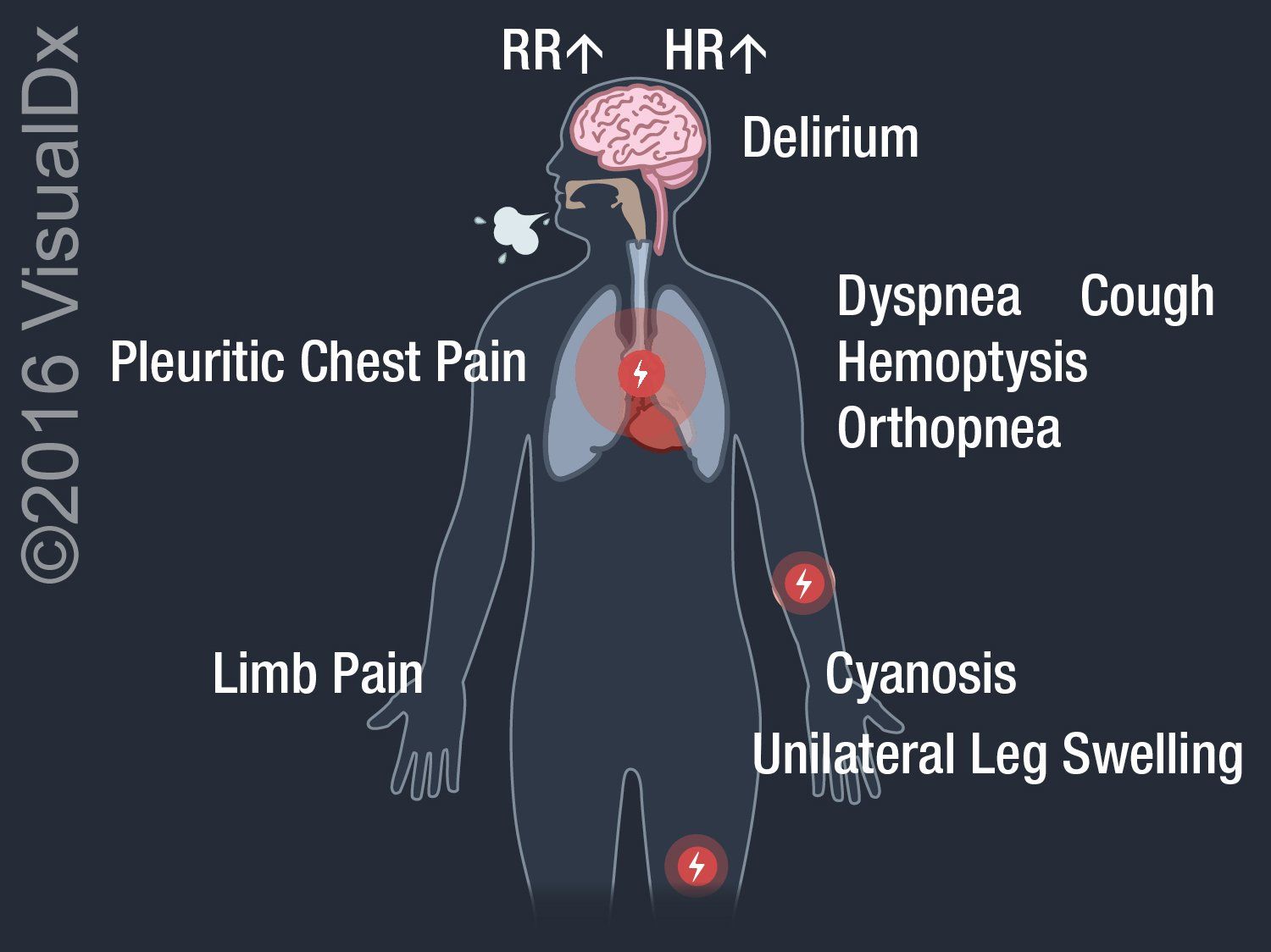 Image Iq Chest Pain Cough Syncope And Shortness Of Breath