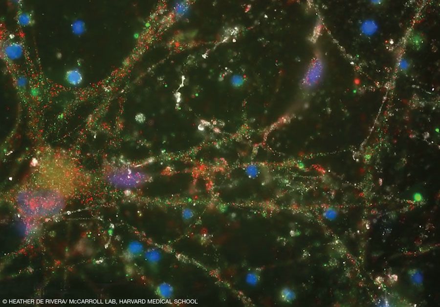 © Heather de Rivera/ McCarroll lab, Harvard Medical School