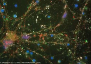 © Heather de Rivera/ McCarroll lab, Harvard Medical School