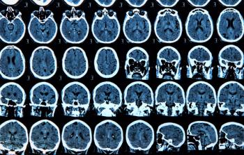 brains
