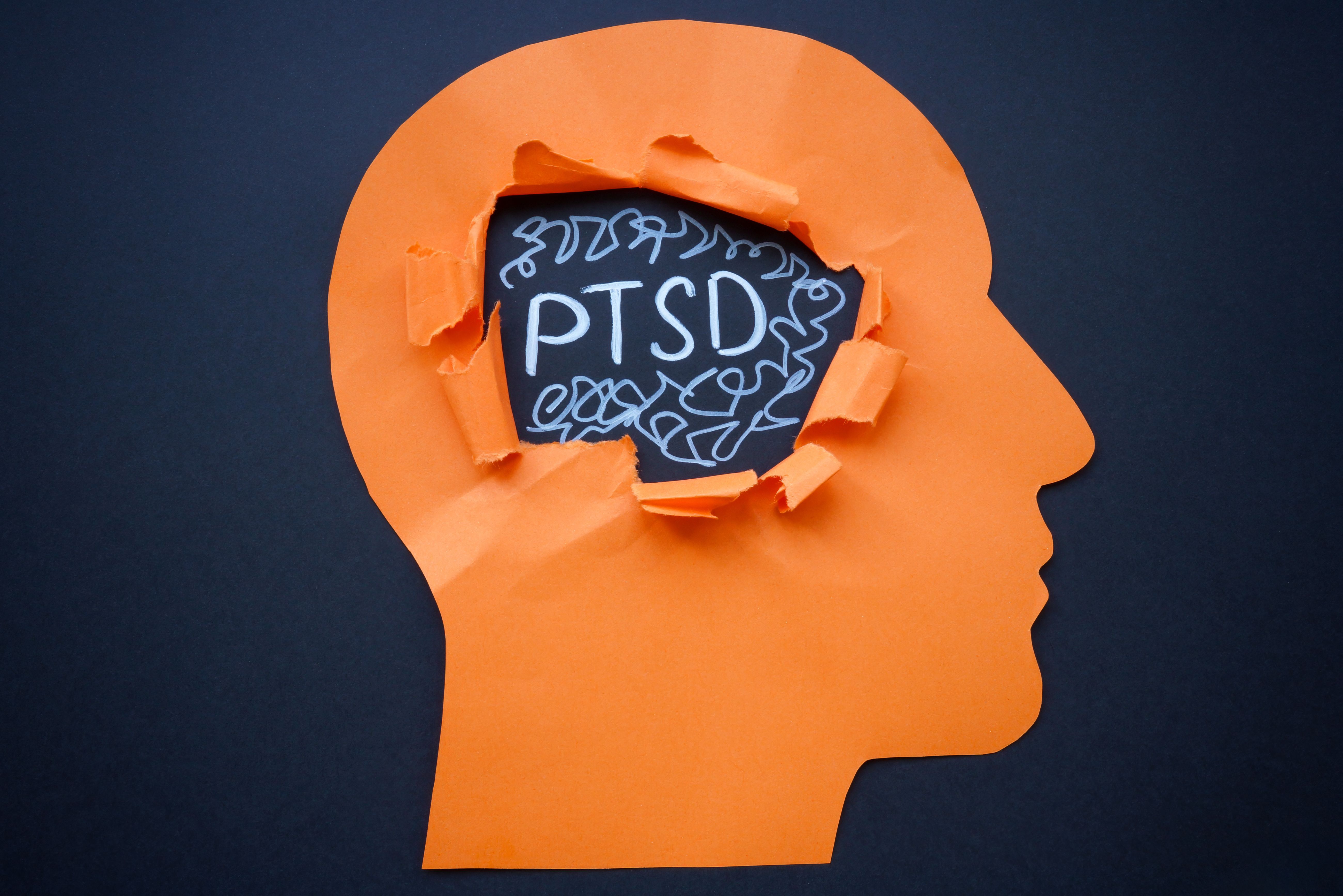 Ptsd Texture Complex PTSD: A Necessary DSM Addition