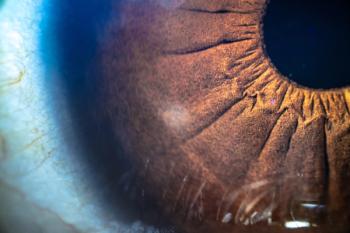 The eyes are a window to the brain. Researchers performed a nationwide cohort study of the risk of retinal disease in patients with bipolar disorder.