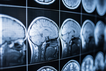 Traumatic brain injury
