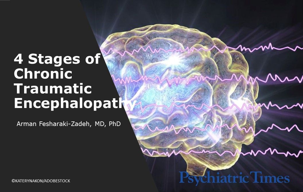 4-stages-of-chronic-traumatic-encephalopathy-psychiatric-times