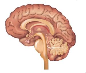 depression treatment ECT