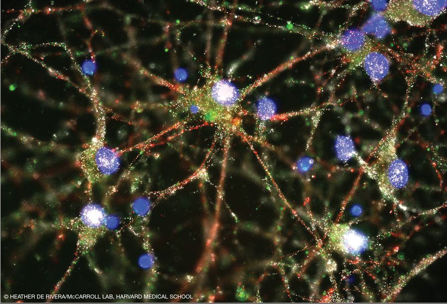 © Heather de Rivera/ McCarroll lab, Harvard Medical School