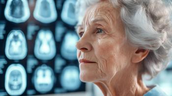 Alzheimer