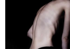 eating disorders. photo credit: MartaKlos@stock.adobe.com