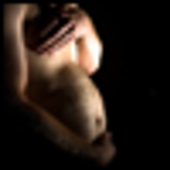 The Management of Patients With Bipolar Depression Who Are Pregnant