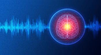 brain electric