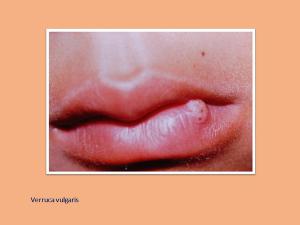 The New, Confusing CPT Codes: How to Get Paid for What You Deserve