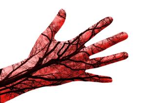 What Food Causes Inflammation?