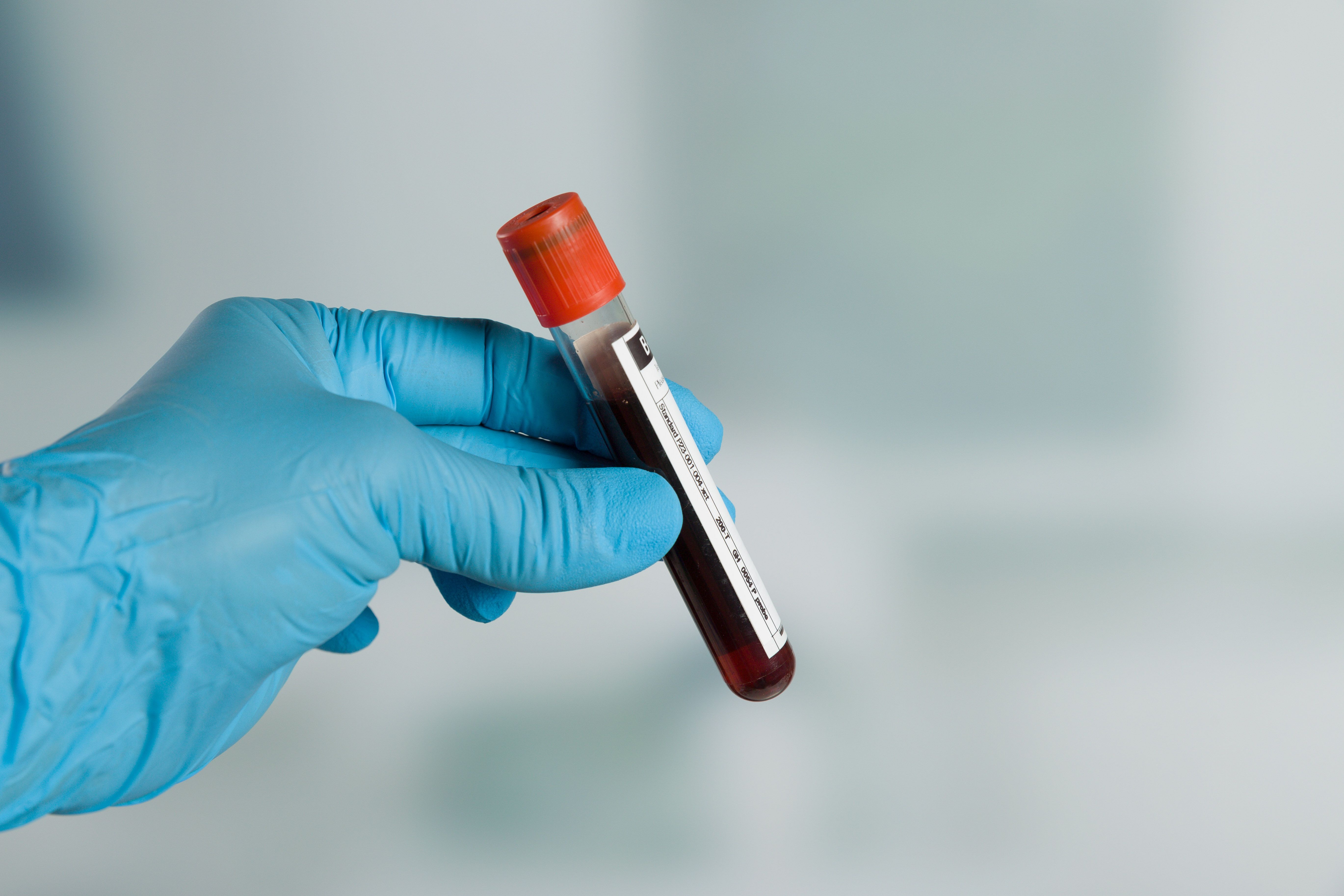 serum level
