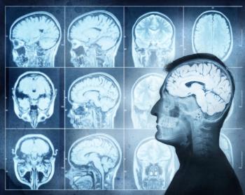 brain