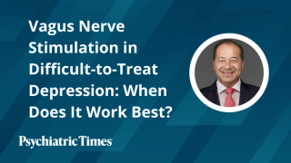 Vagus Nerve Stimulation in Difficult-to-Treat Depression: When Does It Work Best?