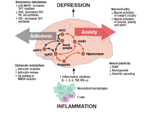 Five Things to Know About Inflammation and Depression