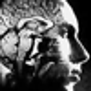 Mixed States in Their Manifold Forms: Part 3