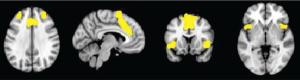 Neural Circuitry of Suicidality