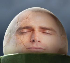 Moving Beyond “Hand Waving”: Why Do People Sleep a Lot After a Traumatic Brain Injury?