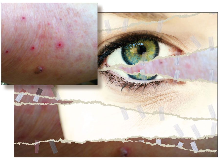 The Interface of Dermatology and Psychiatry