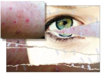 The Interface of Dermatology and Psychiatry