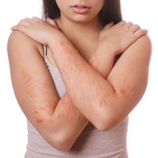 Risky Business: The Higher Risk of Nonsuicidal Self Injury in Bisexual Individuals