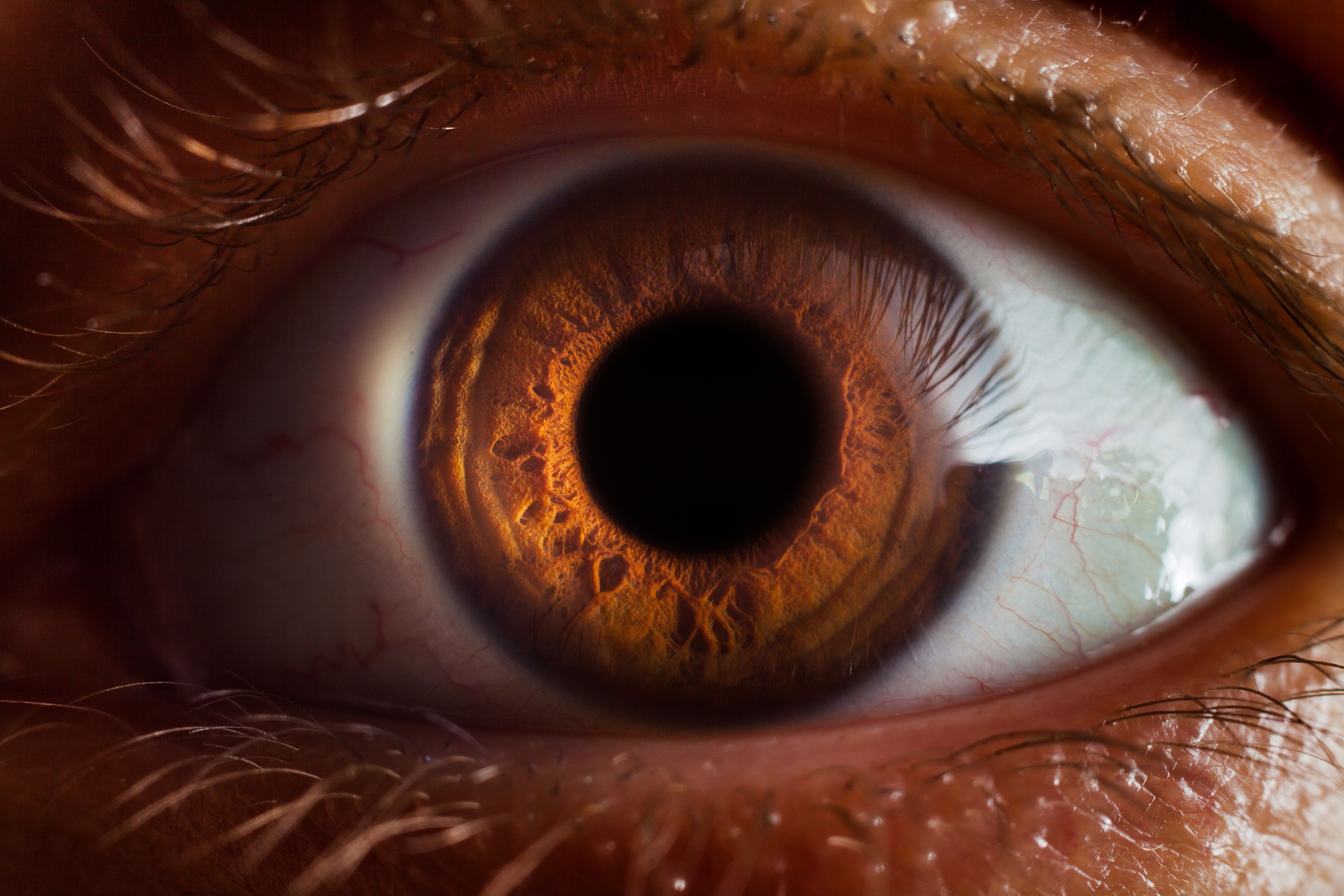 eye