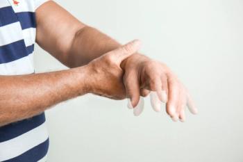 "This study served as a sobering reminder of the significant frequency of this disfiguring and sometimes disabling adverse effect, which can be irreversible."