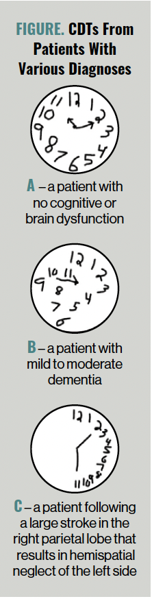 The Clock Drawing Test - B42dfc05e96098e28ee53aabd98a5e19857f7f5b 222x874