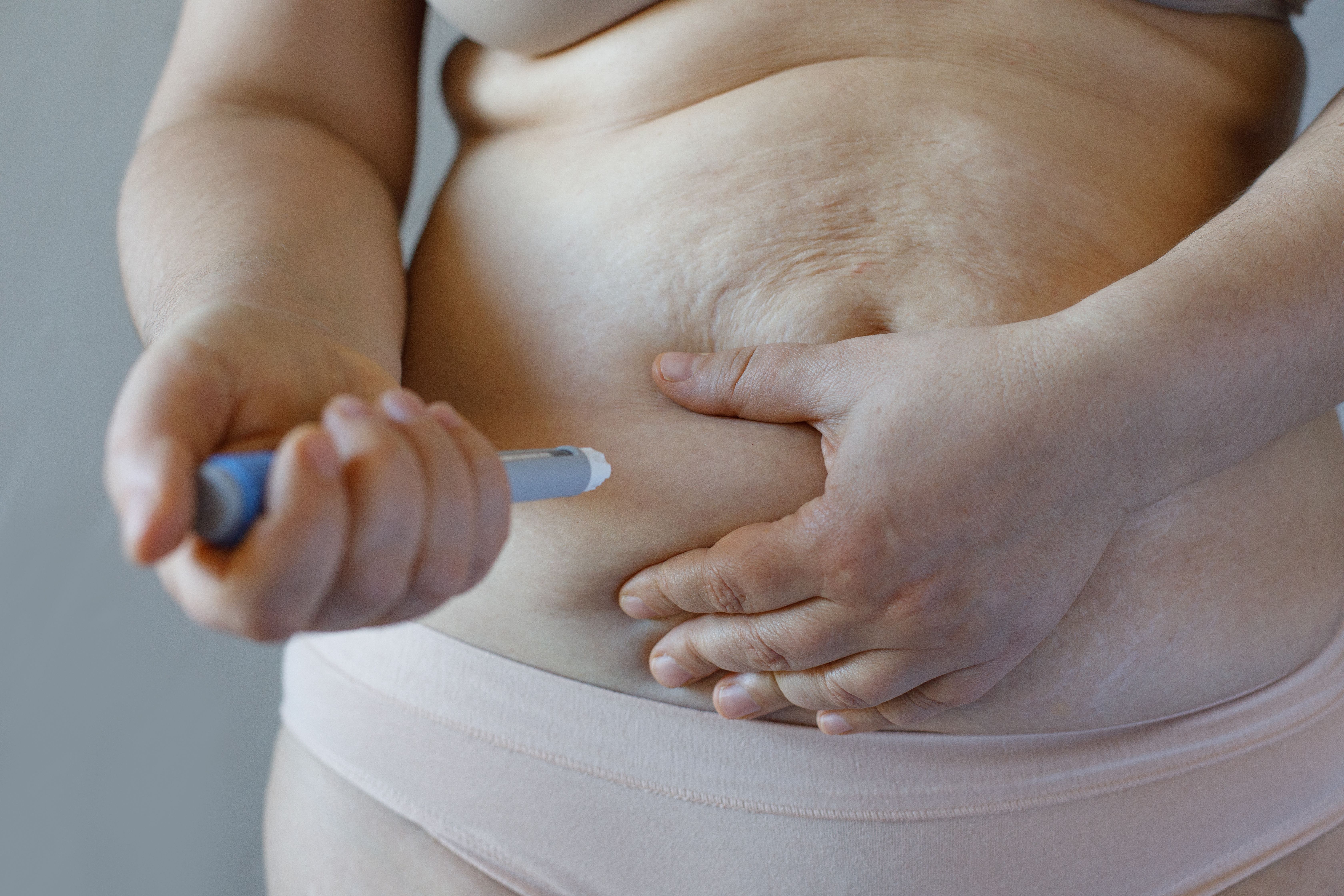 Specter of Suicidality with Antiobesity Med Looms Despite Disparate Study Findings Specter of Suicidality with Antiobesity Med Looms Despite Disparate Study Findings