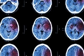 brain injury