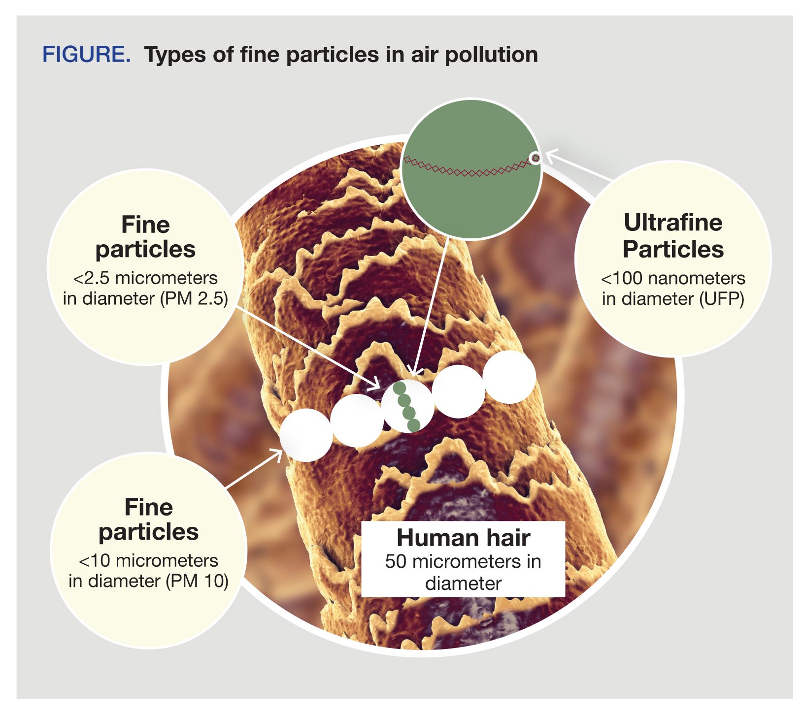 Types of fine particles in air pollution