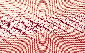 epilepsy and seizure