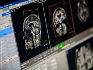 Brain Scan Technology EEG