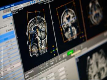 Brain Scan Technology EEG